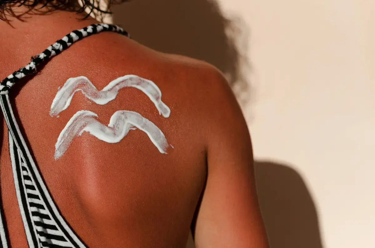Life-Changing Sunburn: Dermatologists Weigh In